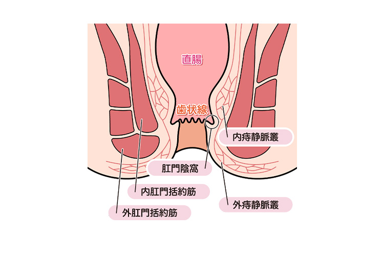 肛門周囲膿瘍・痔瘻の原因のイメージ画像